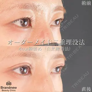 Brandnew Beauty Clinic 望月 聖太医師の症例