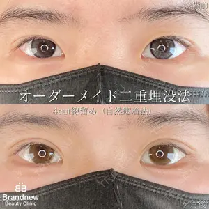 Brandnew Beauty Clinic 望月 聖太医師の症例