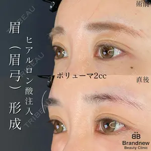 Brandnew Beauty Clinic 望月 聖太医師の症例