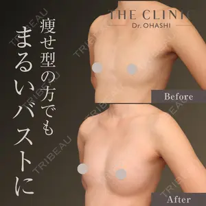 THE CLINIC（ザ・クリニック）東京院 大橋 昌敬医師の症例