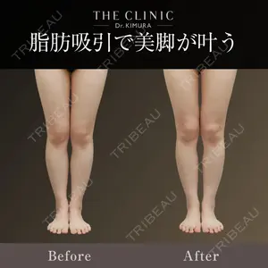 THE CLINIC（ザ・クリニック）広島院 木村 圭吾医師の症例