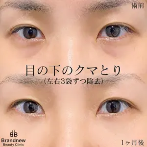 Brandnew Beauty Clinic 望月 聖太医師の症例