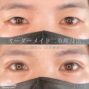 Brandnew Beauty Clinic 望月 聖太医師の症例