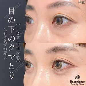 Brandnew Beauty Clinic 望月 聖太医師の症例