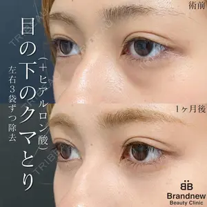 Brandnew Beauty Clinic 望月 聖太医師の症例