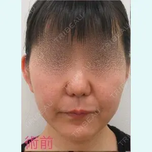銀座TAクリニック 山田 真里江医師の症例
