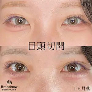 Brandnew Beauty Clinic 望月 聖太医師の症例