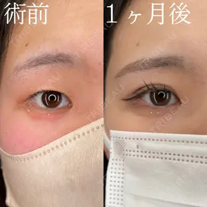 症例