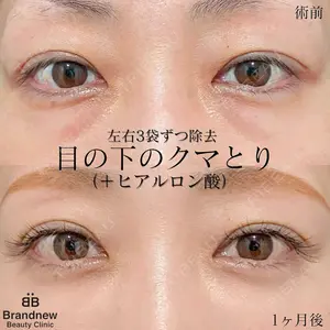 Brandnew Beauty Clinic 望月 聖太医師の症例