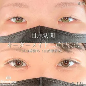 Brandnew Beauty Clinic 望月 聖太医師の症例