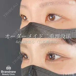 Brandnew Beauty Clinic 望月 聖太医師の症例