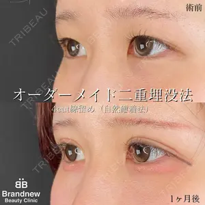 Brandnew Beauty Clinic 望月 聖太医師の症例