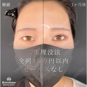 Brandnew Beauty Clinic 望月 聖太医師の症例