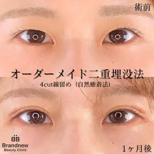 Brandnew Beauty Clinic 望月 聖太医師の症例