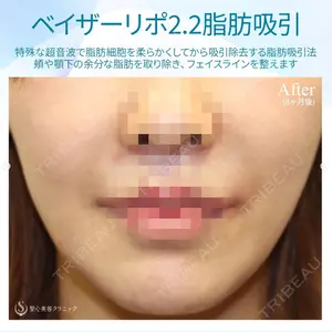 聖心美容クリニック 銀座院 牧野 陽二郎医師の症例