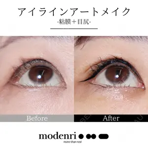 Jfeel（ジェイフィール）クリニック-ホンデ院の症例