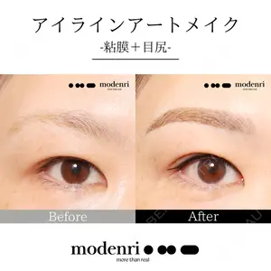 Jfeel（ジェイフィール）クリニック-ホンデ院の症例