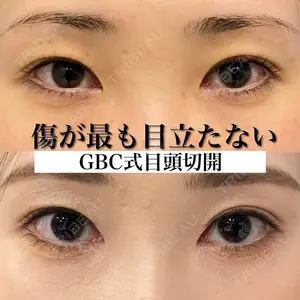 グローバルビューティークリニック 銀座院 理事長　杉崎　裕斗医師の症例