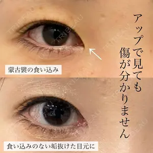 グローバルビューティークリニック 銀座院 理事長　杉崎　裕斗医師の症例