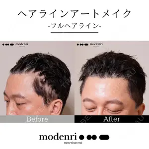 Jfeel（ジェイフィール）クリニック-ホンデ院の症例
