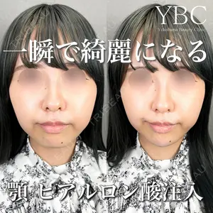 YBC横浜美容外科 大宮院 磯村 亮輔医師の症例