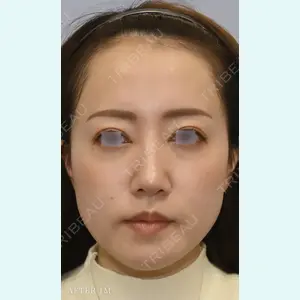 パールスキンクリニック天神 山道光作医師の症例