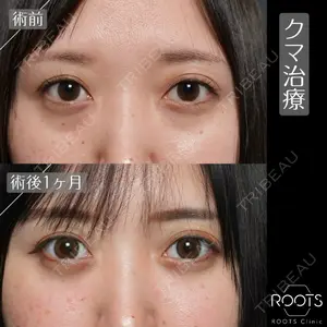 ROOTS Clinic 郭 天元医師の症例