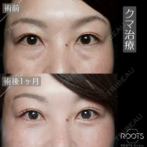 ROOTS Clinic 郭 天元医師の症例