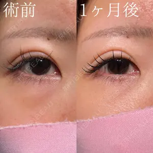 HAAB×DREAM BEAUTY CLINIC 大阪梅田院 鈴木 馨斗医師の症例