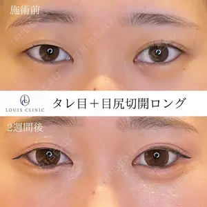 LOUIS CLINIC 二子玉川院【ルイクリニック】 小松 塁医師の症例