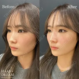 HAAB×DREAM BEAUTY CLINIC 東京本院 佐野 圭医師の症例