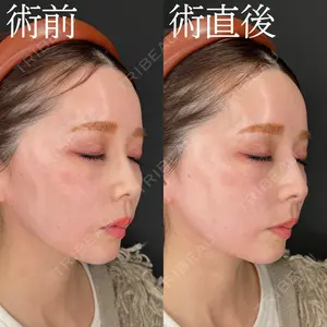 症例