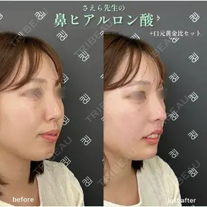 EMMO FACE CLINIC 大阪梅田院 山﨑 冴羅医師の症例