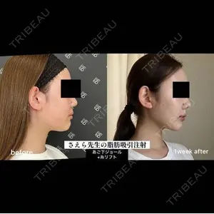 EMMO FACE CLINIC 大阪梅田院 山﨑 冴羅医師の症例