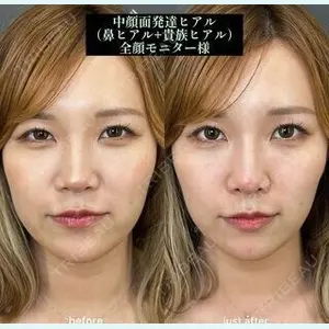 EMMO FACE CLINIC 大阪梅田院 山﨑 冴羅医師の症例