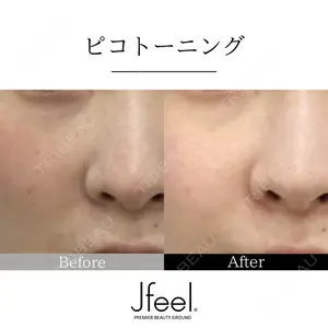 Jfeel（ジェイフィール）クリニック-ホンデ院の症例