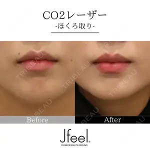 Jfeel（ジェイフィール）クリニック-ホンデ院の症例