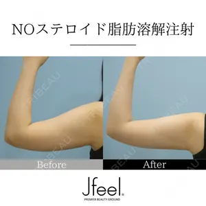 Jfeel（ジェイフィール）クリニック-ホンデ院の症例