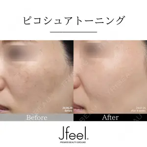 Jfeel（ジェイフィール）クリニック-ホンデ院の症例