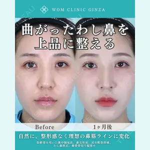 症例