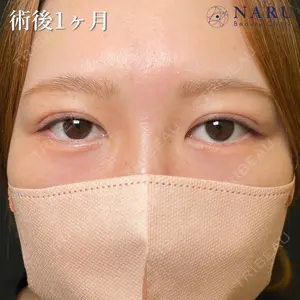 NARU Beauty Clinic 【ナルクリ】 地引 輔医師の症例