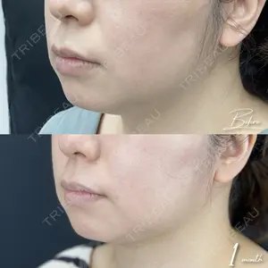 湘南美容クリニック 池袋東口院の症例