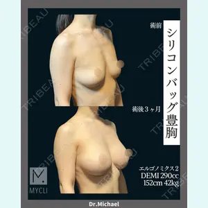 MYCLI【マイクリ】東京・恵比寿院 本田マイケル武史医師の症例