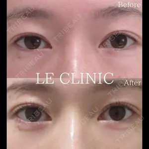 LE CLINIC 喜多　俊博医師の症例