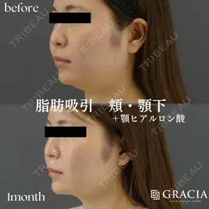 GRACIA clinic 【グラシアクリニック】 谷口　正和医師の症例