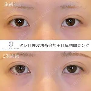 LOUIS CLINIC 二子玉川院【ルイクリニック】 小松 塁医師の症例