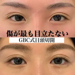 グローバルビューティークリニック 銀座院 理事長　杉崎　裕斗医師の症例