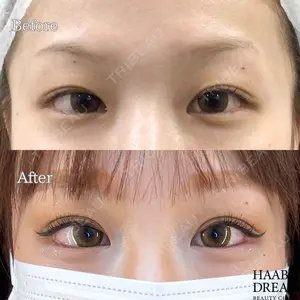 HAAB×DREAM BEAUTY CLINIC 東京本院 田中 優太医師の症例