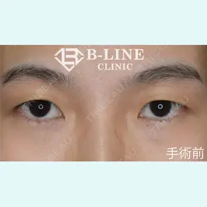 B-LINE CLINIC 池袋院 小池 康弘医師の症例