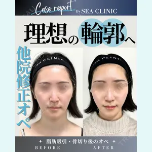 SEA CLINIC（シークリニック） 沼澤 茂医師の症例